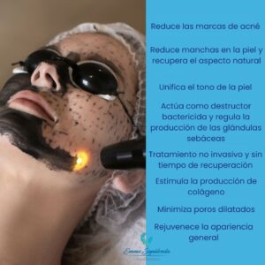 Hollywood Peel 6 SESIONES